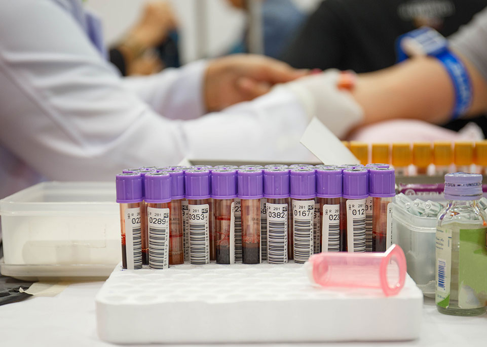 آزمایش آنتی بادی SARS-CoV 2